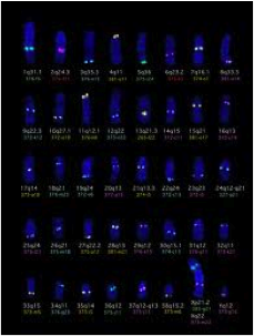 Chromosomes
