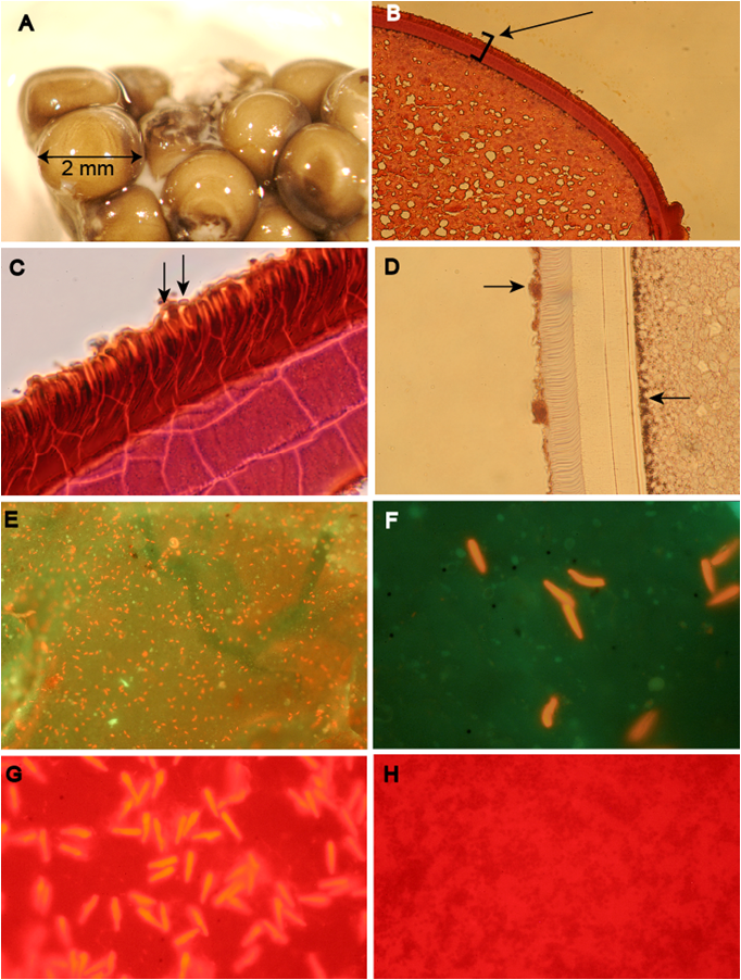 Egg Bacteria